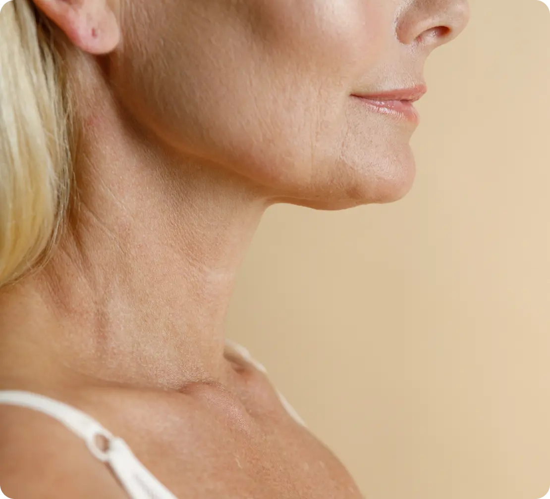Consultation & Preparation for Deep Plane Neck Lift Banner