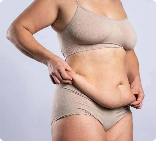 What Is Post-Bariatric Surgery? Banner