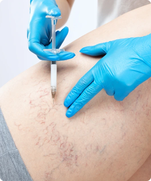 Springfield, MO Vein Conditions: Sclerotherapy Banner