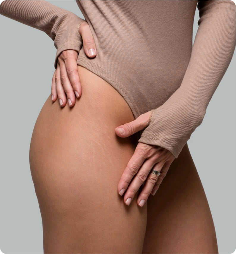 Initial Consultation Thigh Lift Springfield, MO Banner