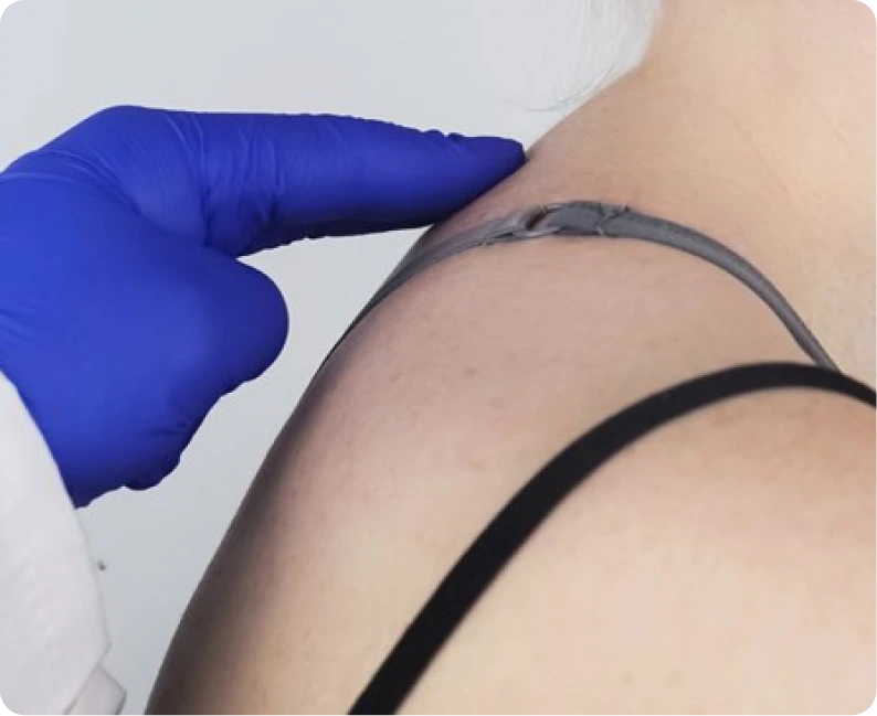 What Is Buffalo Hump Liposuction Springfield, MO Banner